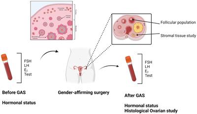 Histological ovarian features and hormonal determinations in assigned females at birth transgender individuals according to different testosterone preparations